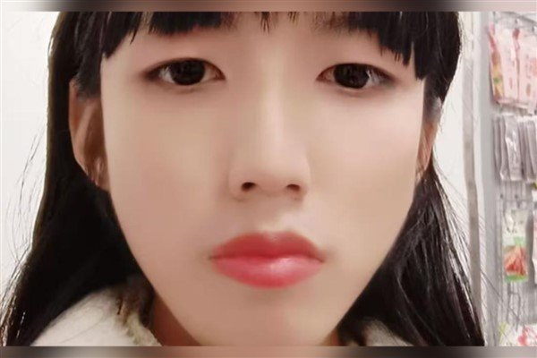 Transgender kadın, elektroşok tedavisinin ardından Çin'de rekor tazminat kazandı