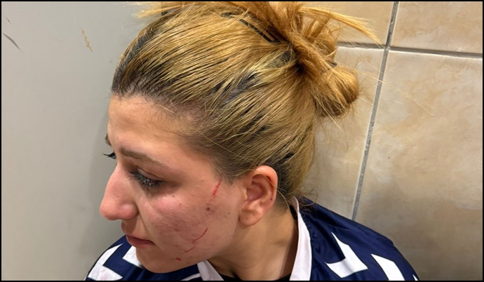 Şanlıurfa Güneşin Çocukları Hentbol Takımı Play-Off’a Yükseldi, Ancak Saldırıya Uğradı