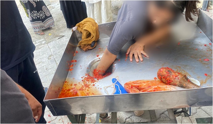 Salça Makinesine Eli Sıkışan Genç Kız Kurtarıldı-(VİDEO)