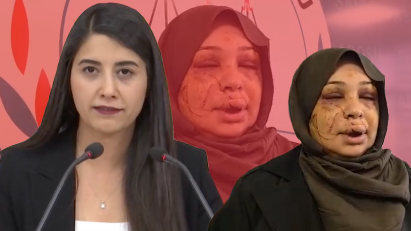 Milletvekili Ayan’dan Sert Çıkış: Şiddet İddialarına Rağmen Serbestlik Kararı