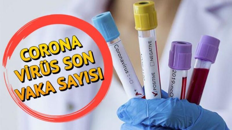 Bakan Koca,Son verileri açıkladı..Ağır hasta sayısı artıyor !