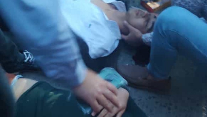 Cizre’de kaza: 2 çocuk yaralandı