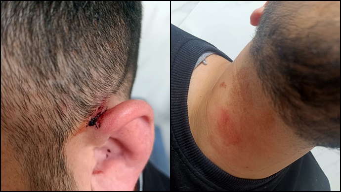 Dicle Elektrik Çalışanlarına Saldırıda Yeni Gelişme:Kalaşnikoflu Saldırganlar Mahkeme Tarafından Serbest Bırakıldı