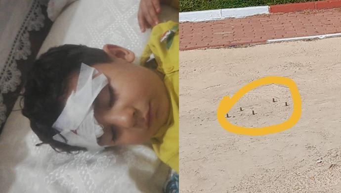 Eyyübiye’nin çocuk parkı hastanelik etti: Ailesi Savcılık’a suç duyurusunda bulunacak