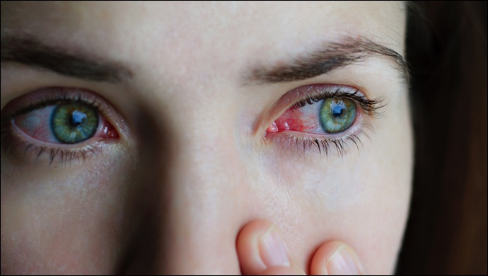 Körlüğün Yüzde 80’i Önlenebilir nedenlere bağlı