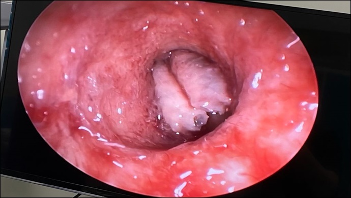 Kulaktan çıkana inanamayacaksınız !