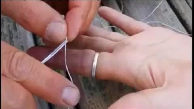 Parmağına sıkışan yüzüğü itfaiye çıkardı