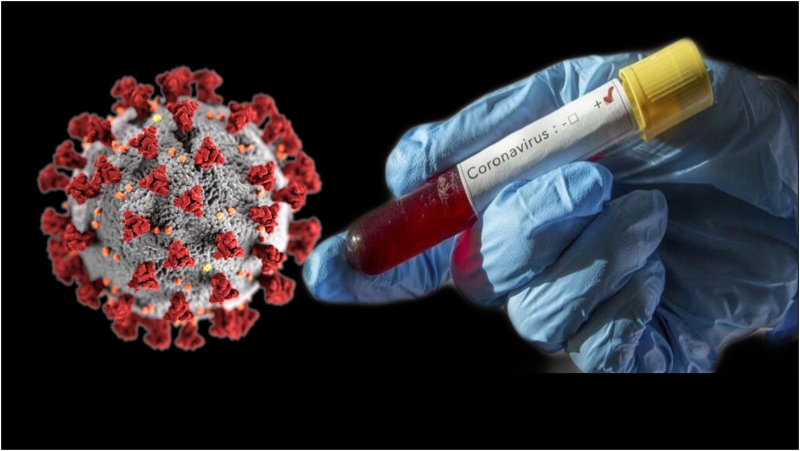 Şanlıurfa'da 24 yerde karantina kaldırıldı!