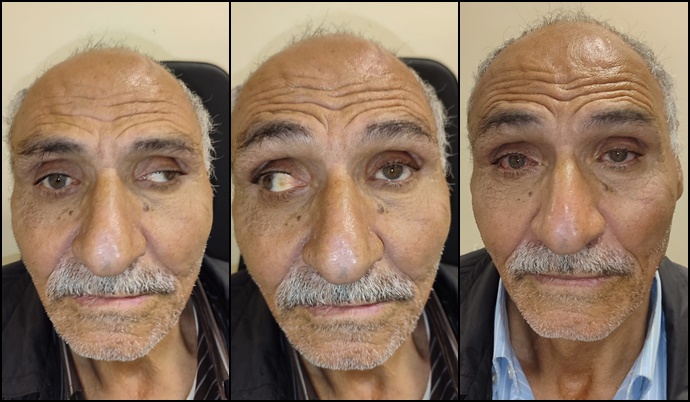 Şanlıurfa'da 68 Yıl Sonra Gelen Mutluluk