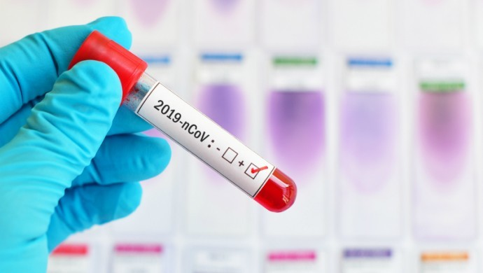 SON DAKİKA | İşte bugünkü koronavirüs bilançosu!