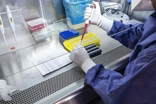 Yakın Doğu Üniversitesi, grip ve covid-19’u aynı örnekten saptayan Hibrit PCR Tanı Kiti geliştirdi 